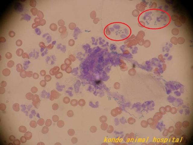 赤丸の中に球菌と好中球を確認できます。
