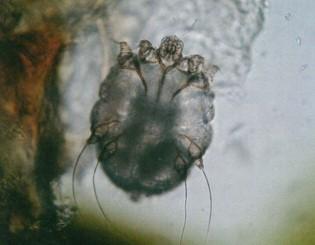 顕微鏡で見られる「疥癬虫」